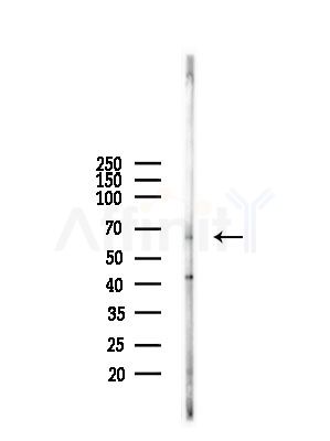 Phospho-PTRF (Tyr156) Antibody - Western blot analysis of lysates from A375 cells(starvation,24h treatment), using Phospho-PTRF (Tyr156) Antibody at 1/1000 dilution.