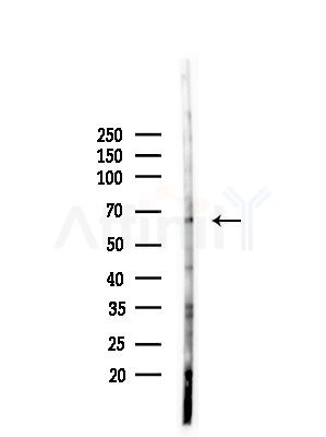 Phospho-PTRF (Tyr156) Antibody - Western blot analysis of lysates from PC12 cells(LPS, 4h treatment), using Phospho-PTRF (Tyr156) Antibody at 1/1000 dilution.