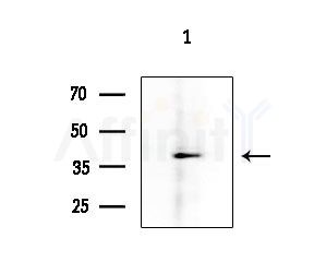 Phospho-RCC1 (Ser11) Antibody - Western blot analysis of lysates from 293 cells
(LPS 4h treatment), using Phospho-RCC1 (Ser11) Antibody at 1/1000 dilution.