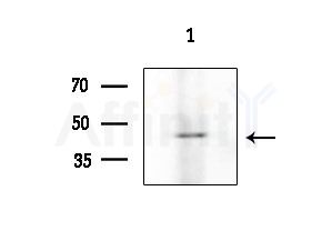 Phospho-RCC1 (Ser11) Antibody - Western blot analysis of lysates from Hela cells
(heat-shock treatment), using Phospho-RCC1 (Ser11) Antibody at 1/1000 dilution.