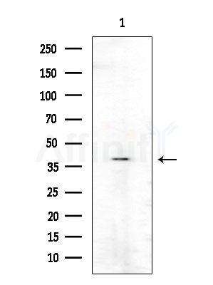 Phospho-RCC1 (Ser11) Antibody - Western blot analysis of lysates from Mouse testis, using Phospho-RCC1 (Ser11) Antibody at 1/1000 dilution.