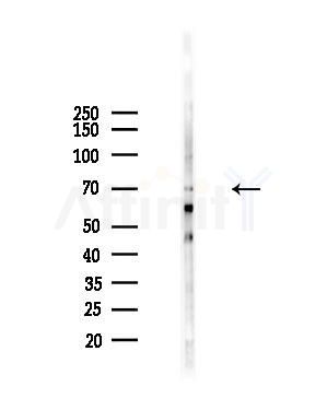Phospho-SLAM / CD150 (Tyr281) Antibody - Western blot analysis of lysates from 293 cells(starvation,24h treatment), using Phospho-SLAM / CD150 (Tyr281) Antibody at 1/1000 dilution.