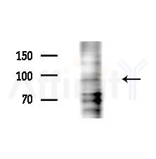 Phospho-TRPV1(Ser502) Antibody - Western blot analysis of lysates from HepG2 cells(LPS, 4h treatment), using Phospho-TRPV1(Ser502) Antibody at 1/1000 dilution.