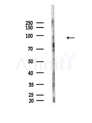 Phospho-TRPV1(Ser502) Antibody - Western blot analysis of lysates from HepG2 cells(LPS, 4h treatment), using Phospho-TRPV1(Ser502) Antibody at 1/1000 dilution.