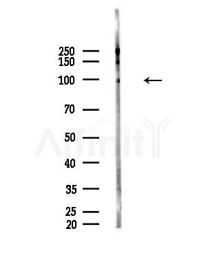 Phospho-XRCC1 (Thr284) Antibody - Western blot analysis of lysates from HepG2 cells(LPS, 4h treatment), using Phospho-XRCC1 (Thr284) Antibody at 1/1000 dilution.
