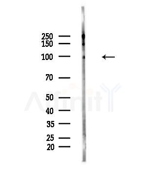 Phospho-XRCC1 (Thr284) Antibody - Western blot analysis of lysates from HepG2 cells(LPS, 4h treatment), using Phospho-XRCC1 (Thr284) Antibody at 1/1000 dilution.