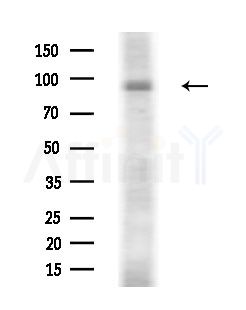 Phospho-AXL (Tyr698) Antibody - Western blot analysis of extracts from Rat brain, using Phospho-AXL (Tyr698) Antibody at 1/1000 dilution.