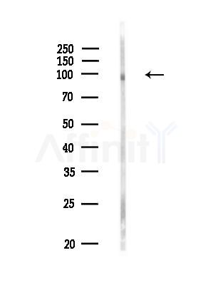 Phospho-AXL (Tyr698) Antibody - Western blot analysis of lysates from Rat brain, using Phospho-AXL (Tyr698) Antibody at 1/1000 dilution.