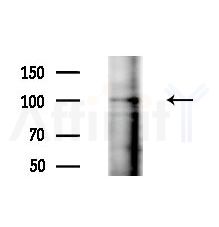 Phospho-AXL (Tyr702) Antibody - Western blot analysis of extracts from HepG2 cells(LPS, 4h treatment), using Phospho-AXL (Tyr702) Antibody at 1/1000 dilution.