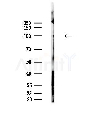 Phospho-AXL (Tyr702) Antibody - Western blot analysis of lysates from HepG2 cells(LPS, 4h treatment), using Phospho-AXL (Tyr702) Antibody at 1/1000 dilution.