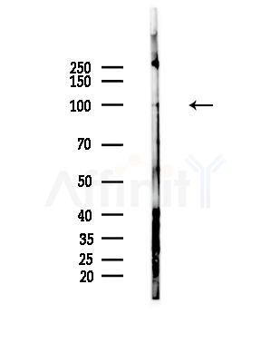 Phospho-AXL (Tyr702) Antibody - Western blot analysis of lysates from HepG2 cells(LPS, 4h treatment), using Phospho-AXL (Tyr702) Antibody at 1/1000 dilution.