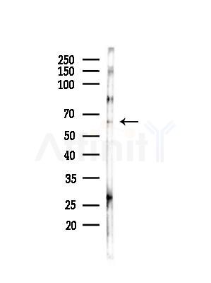 Phospho-SQSTM1/p62 (Ser28) Antibody - Western blot analysis of lysates from Hela cells(starvation,24h treatment), using Phospho-SQSTM1/p62 (Ser28) Antibody at 1/1000 dilution.