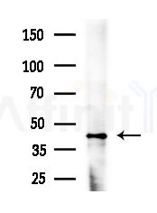 Phospho-FH (Thr90) Antibody - Western blot analysis of extracts from HepG2 cells(LPS,4h treatment), using Phospho-FH (Thr90) Antibody at 1/1000 dilution.