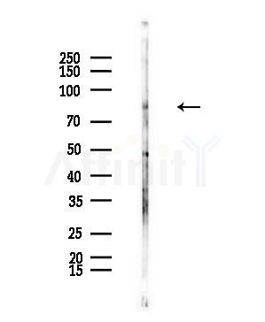 Phospho-EZH2 (Thr369) Antibody  - Western blot analysis of lysates from Rat brain, using Phospho-EZH2 (Thr369) Antibody  at 1/1000 dilution.
