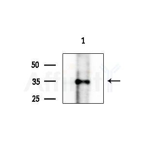Phospho-PRPS1 (Ser180) Antibody - Western blot analysis of lysates from Hela cells(starvation treatment), using Phospho-PRPS1 (Ser180) Antibody at 1/1000 dilution.