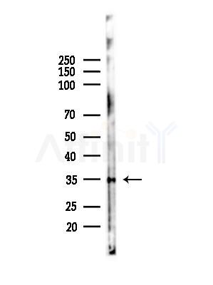 Phospho-PRPS1 (Ser180) Antibody - Western blot analysis of lysates from Hela cells(starvation,24h treatment), using Phospho-PRPS1 (Ser180) Antibody at 1/1000 dilution.