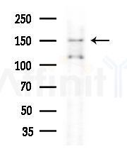 Phospho-DEPDC5 (Ser1002) Antibody - Western blot analysis of extracts from COLO205 cells(heat-shock,45min treatment), using Phospho-DEPDC5 (Ser1002) Antibody at 1/1000 dilution.