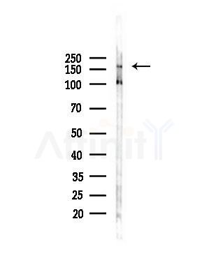 Phospho-DEPDC5 (Ser1002) Antibody - Western blot analysis of lysates from COLO205 cells(heat-shock,45min treatment), using Phospho-DEPDC5 (Ser1002) Antibody at 1/1000 dilution.