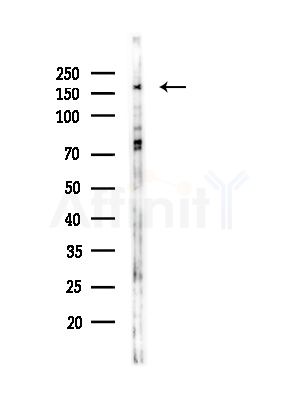 Phospho-DEPDC5 (Ser1530) Antibody - Western blot analysis of lysates from COLO205 cells, using Phospho-DEPDC5 (Ser1530) Antibody at 1/1000 dilution.