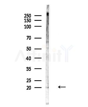 Phospho-MLC2 (Ser15) Antibody - Western blot analysis of lysates from Hela cells(UV,30min treatment), using Phospho-MLC2 (Ser15) Antibody at 1/1000 dilution.