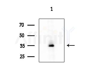Acrosin Antibody - Western blot analysis of extracts from HUVEC cells, using Acrosin Antibody at 1/1000 dilution.