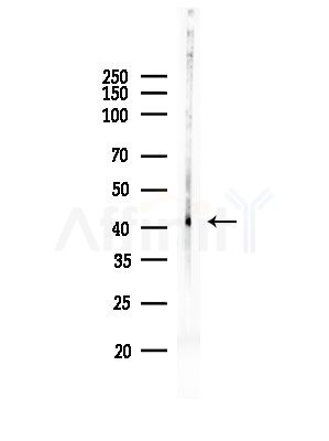 Acrosin Antibody - Western blot analysis of lysates from HUVEC cells, using Acrosin Antibody at 1/1000 dilution.