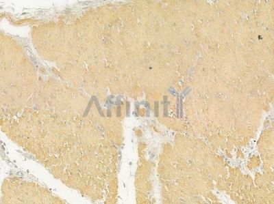 Actin-alpha/gamma Antibody - AF9004 at 1/100 staining human normal gastric tissue by IHC-P.