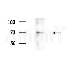 A-Myb Antibody - Western blot analysis of extracts from Rat brain, using A-Myb Antibody at 1/1000 dilution.