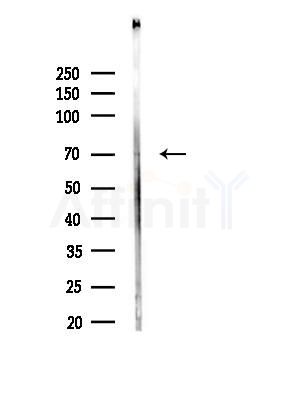 A-Myb Antibody - Western blot analysis of lysates from 3T3-L1 cells(heat-shock,45min treatment), using A-Myb Antibody at 1/1000 dilution.