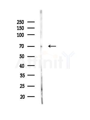 A-Myb Antibody - Western blot analysis of lysates from Rat brain, using A-Myb Antibody at 1/1000 dilution.