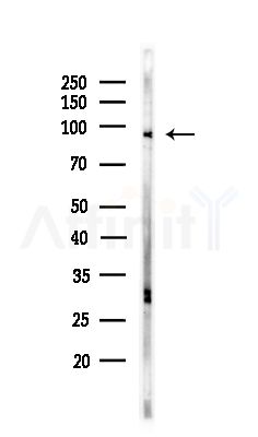 ANKRD20 Antibody - Western blot analysis of lysates from COLO205 cells(UV,30min treatment), using ANKRD20 Antibody at 1/1000 dilution.