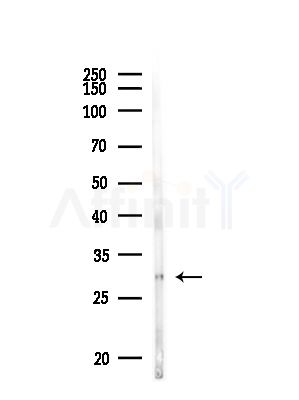 ApoOL Antibody - Western blot analysis of lysates from MDA-MB-231 cells(heat-shock,45min treatment), using ApoOL Antibody at 1/1000 dilution.
