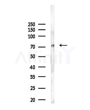 ARHGAP22 Antibody - Western blot analysis of lysates from PC12 cells(LPS 4h treatment), using ARHGAP22 Antibody at 1/1000 dilution.
