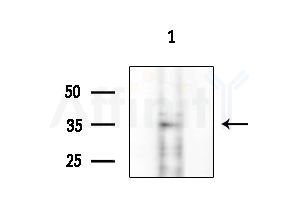 Arrestin C Antibody - Western blot analysis of extracts from 293 cells
(LPS 4h treatment), using Arrestin C Antibody at 1/1000 dilution.