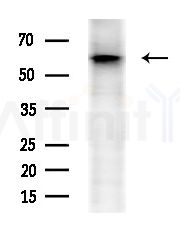 BEGAIN Antibody - Western blot analysis of extracts from EC304 cells(heat-shock treatment), using BEGAIN Antibody at 1/1000 dilution.
