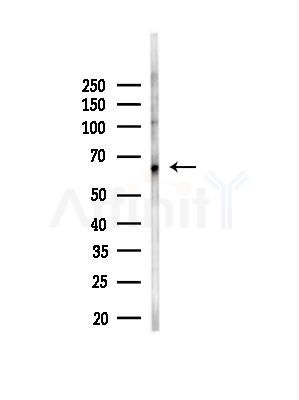 BEGAIN Antibody - Western blot analysis of lysates from EC304 cells(heat-shock,45min treatment), using BEGAIN Antibody at 1/1000 dilution.