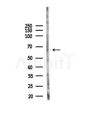 BEGAIN Antibody - Western blot analysis of lysates from HepG2 cells(starvation,24h treatment), using BEGAIN Antibody at 1/1000 dilution.
