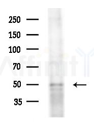 BTBD6 Antibody - Western blot analysis of extracts from HepG2 cells(starvation treatment), using BTBD6 Antibody at 1/1000 dilution.