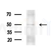 BTBD6 Antibody - Western blot analysis of extracts from EC304 cells(heat-shock treatment), using BTBD6 Antibody at 1/1000 dilution.