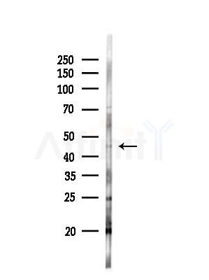 BTBD6 Antibody - Western blot analysis of lysates from EC304 cells(heat-shock,45min treatment), using BTBD6 Antibody at 1/1000 dilution.