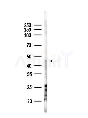 BTBD6 Antibody - Western blot analysis of lysates from HepG2 cells(starvation,24h treatment), using BTBD6 Antibody at 1/1000 dilution.