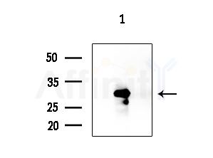 CaMKIbeta Antibody - Western blot analysis of extracts from EC304 cells, using CaMKIbeta Antibody at 1/1000 dilution.