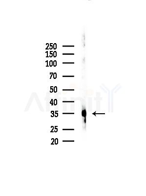 CaMKIbeta Antibody - Western blot analysis of lysates from EC304 cells, using CaMKIbeta Antibody at 1/1000 dilution.