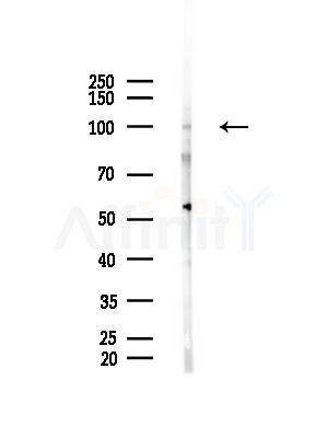CTNNA1/CTNNA2 Antibody - Western blot analysis of lysates from HepG2 cells(LPS, 4h treatment), using CTNNA1/CTNNA2 Antibody at 1/1000 dilution.
