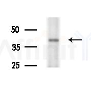 CD158f2 Antibody - Western blot analysis of extracts from HepG2 cells(starvation treatment), using CD158f2 Antibody at 1/1000 dilution.