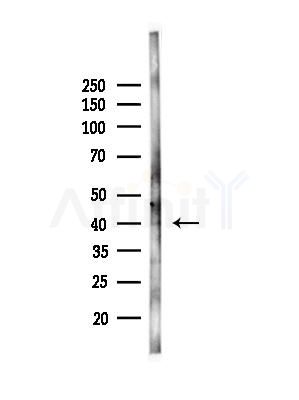 CD158f2 Antibody - Western blot analysis of lysates from EC304 cells(heat-shock,45min treatment), using CD158f2 Antibody at 1/1000 dilution.