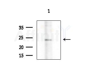 CMTM4 Antibody - Western blot analysis of extracts from 293 cells
(LPS 4h treatment), using CMTM4 Antibody at 1/1000 dilution.