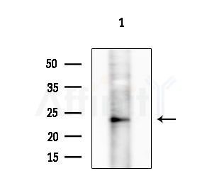 CMTM4 Antibody - Western blot analysis of extracts from Hela cells
(heat-shock treatment), using CMTM4 Antibody at 1/1000 dilution.