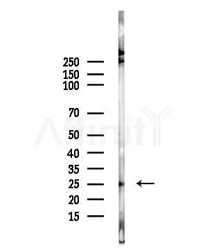 CMTM4 Antibody - Western blot analysis of lysates from Hela cells(heat-shock,45min treatment), using CMTM4 Antibody at 1/1000 dilution.