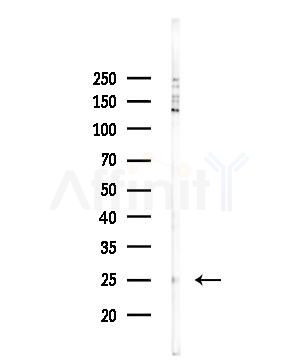 CMTM4 Antibody - Western blot analysis of lysates from 293 cells(LPS,4h treatment), using CMTM4 Antibody at 1/1000 dilution.